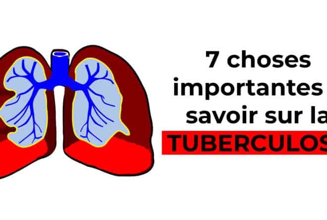 Mali : 7 choses importantes à savoir sur la tuberculose