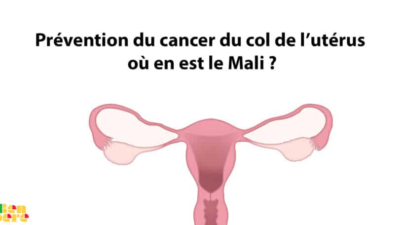 Au Mali, 1200 femmes meurent chaque année du cancer du col de l’utérus